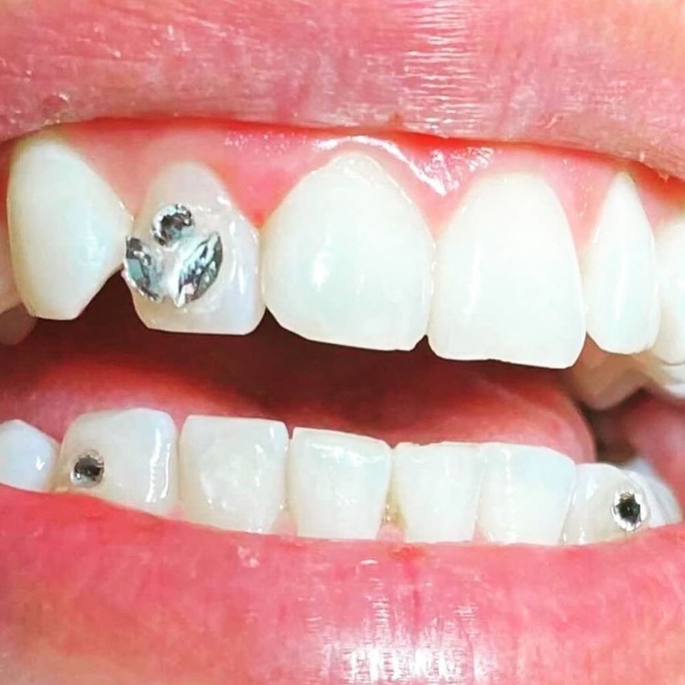 close-up of a smiling mouth with silver and diamond-like tooth gems on a few of the teeth